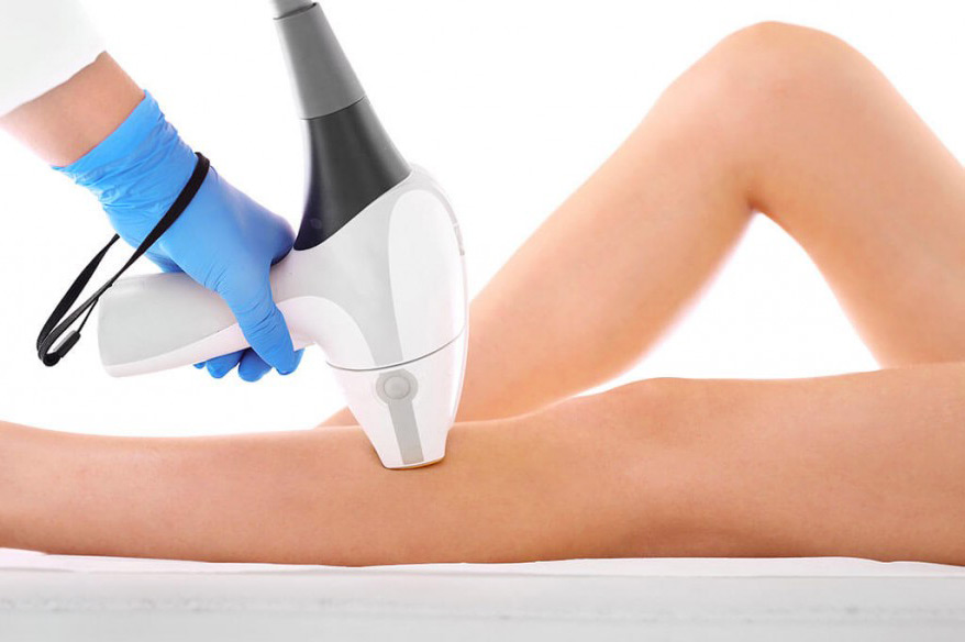 Comment choisir son épilateur à lumière pulsée ?